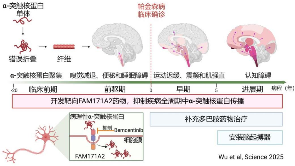 我國科學家發現帕金森病治療新靶點