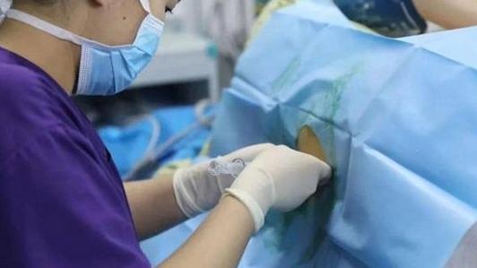 “無痛”分娩服務，將全國普及！