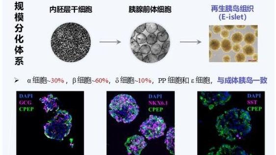 干细胞“智造”胰岛！1型糖尿病治疗迎曙光